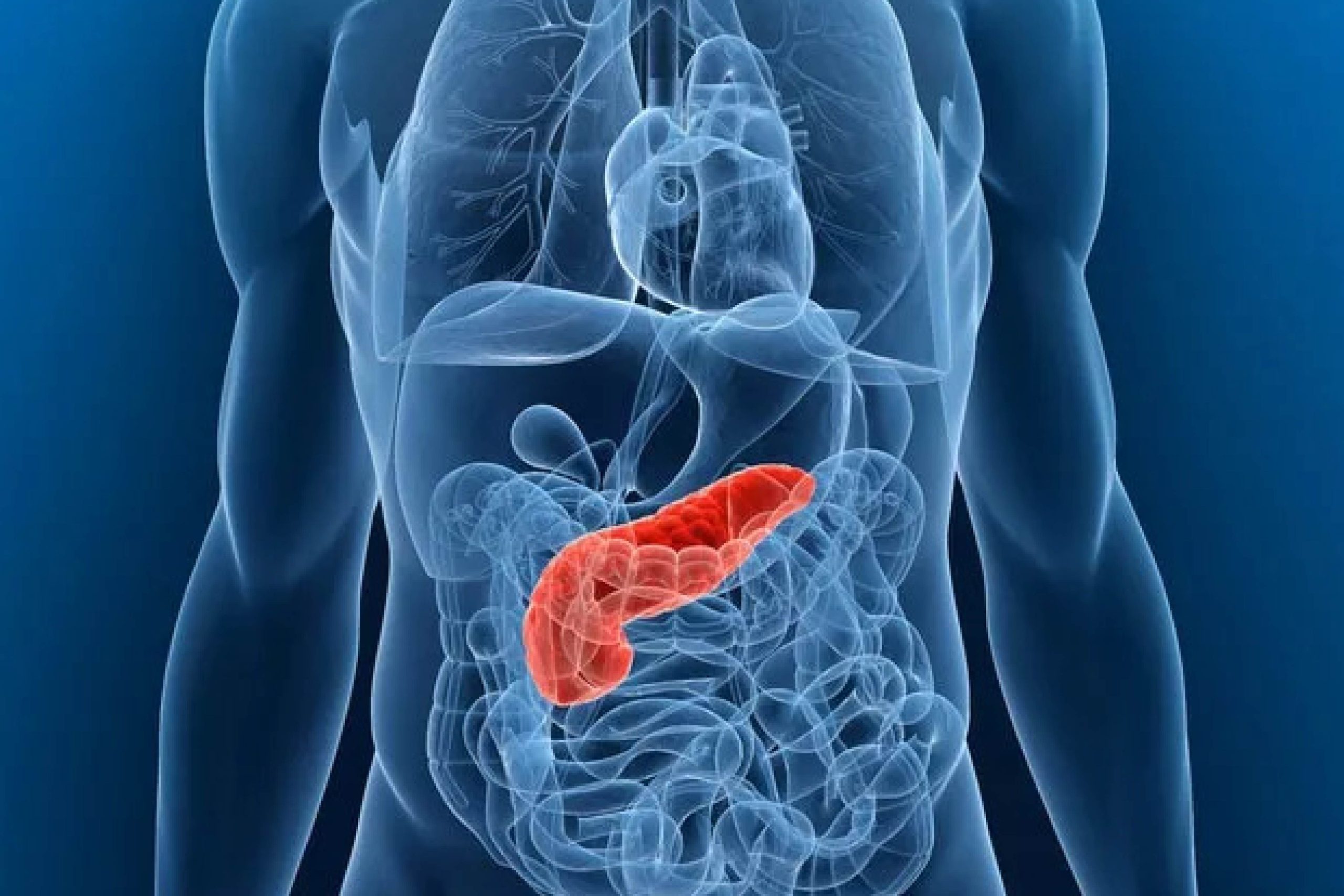 Pancreatic Cancer